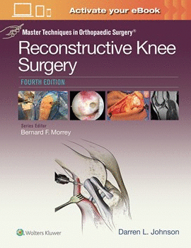 MASTER TECHNIQUES IN ORTHOPAEDIC SURGERY: RECONSTRUCTIVE KNEE SURGERY. 4TH EDITION