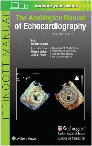 THE WASHINGTON MANUAL OF ECHOCARDIOGRAPHY. 2ND EDITION