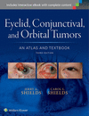 EYELID, CONJUNCTIVAL, AND ORBITAL TUMORS: AN ATLAS AND TEXTBOOK, 3TH EDITION