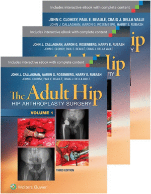 THE ADULT HIP. ARTHROPLASTY AND ITS ALTERNATIVES + HIP PRESERVATION SURGERY, 3 VOLS. 3RD EDITION