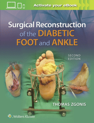 SURGICAL RECONSTRUCTION OF THE DIABETIC FOOT AND ANKLE. 2ND EDITION