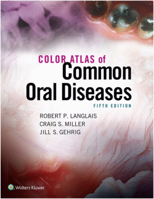 COLOR ATLAS OF COMMON ORAL DISEASES. 5TH EDITION