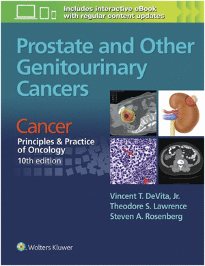 PROSTATE AND OTHER GENITOURINARY CANCERS. CANCER: PRINCIPLES & PRACTICE OF ONCOLOGY, 10TH EDITION