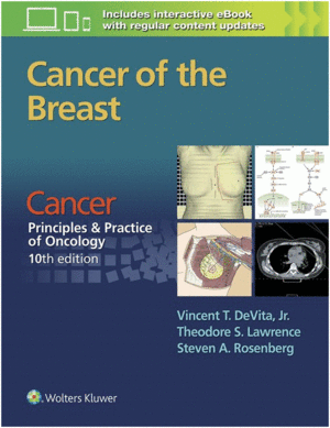 CANCER OF THE BREAST. FROM CANCER: PRINCIPLES & PRACTICE OF ONCOLOGY, 10TH EDITION