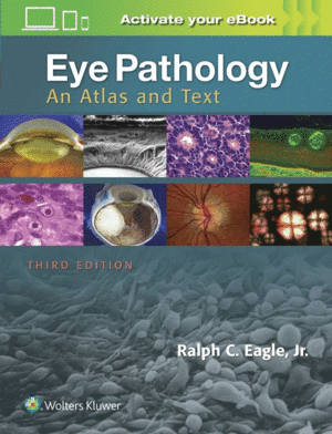 EYE PATHOLOGY. AN ATLAS AND TEXT. 3RD EDITION