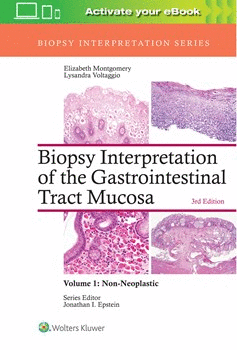 BIOPSY INTERPRETATION OF THE GASTROINTESTINAL TRACT MUCOSA, VOL. 1: NON-NEOPLASTIC. 3RD EDITION