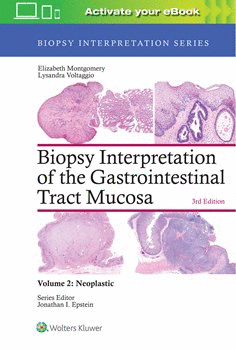 BIOPSY INTERPRETATION OF THE GASTROINTESTINAL TRACT MUCOSA, VOL. 2: NEOPLASTIC. 3RD EDITION