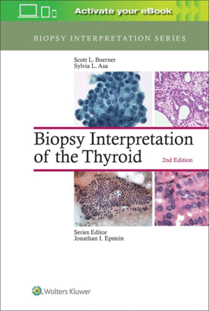 BIOPSY INTERPRETATION OF THE THYROID. 2ND EDITION