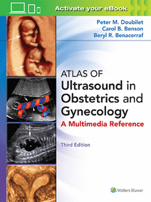 ATLAS OF ULTRASOUND IN OBSTETRICS AND GYNECOLOGY. 3RD EDITION