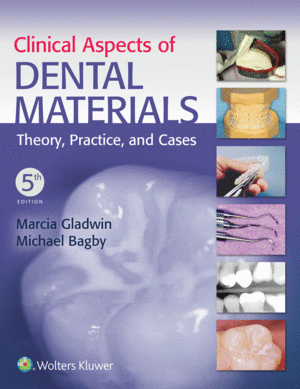 CLINICAL ASPECTS OF DENTAL MATERIALS. THEORY, PRACTICE, AND CASES. 5TH EDITION