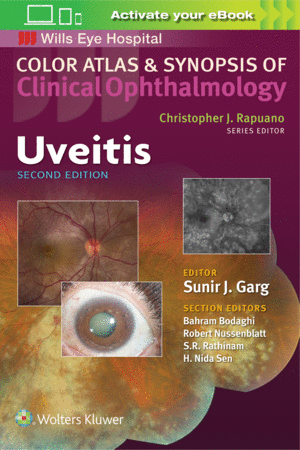 UVEITIS (COLOR ATLAS AND SYNOPSIS OF CLINICAL OPHTHALMOLOGY). 2ND EDITION