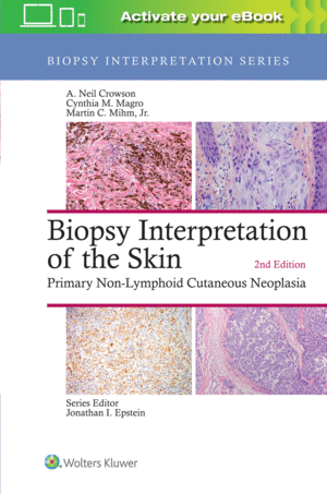 BIOPSY INTERPRETATION OF THE SKIN (BIOPSY INTERPRETATION SERIES). 2ND EDITION