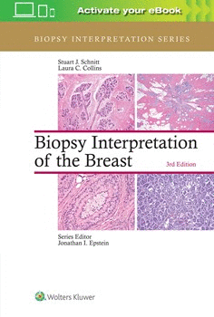 BIOPSY INTERPRETATION OF THE BREAST. 3RD EDITION