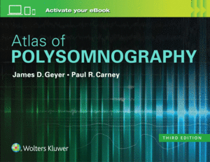 ATLAS OF POLYSOMNOGRAPHY. 3RD EDITION