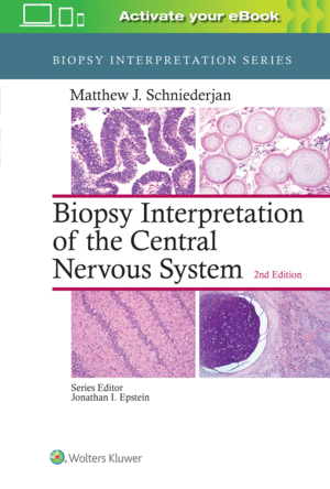 BIOPSY INTERPRETATION OF THE CENTRAL NERVOUS SYSTEM. 2ND EDITION