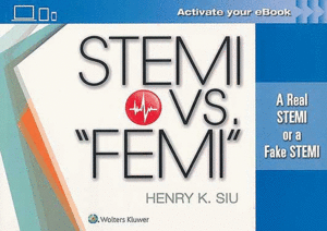 STEMI VS. FEMI