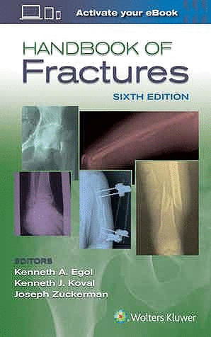 HANDBOOK OF FRACTURES. 6TH EDITION