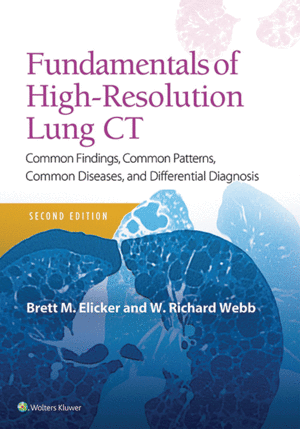 FUNDAMENTALS OF HIGH-RESOLUTION LUNG CT. COMMON FINDINGS, COMMON PATTERNS, COMMON DISEASES AND DIFFERENTIAL DIAGNOSIS. 2ND EDITION