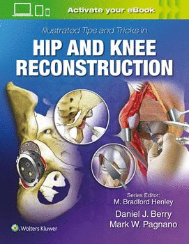 MAYOS ILLUSTRATED TIPS AND TRICKS IN HIP AND KNEE RECONSTRUCTIVE AND REPLACEMENT SURGERY
