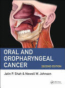 ORAL AND OROPHARYNGEAL CANCER. 2ND EDITION