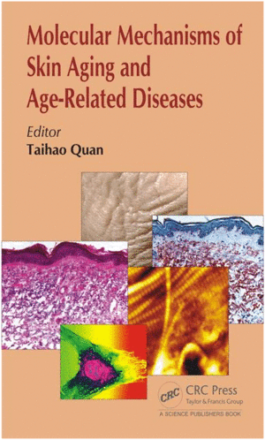 MOLECULAR MECHANISMS OF SKIN AGING AND AGE-RELATED DISEASES