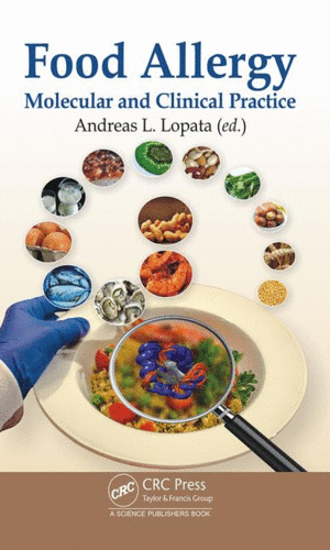 FOOD ALLERGY. MOLECULAR AND CLINICAL PRACTICE