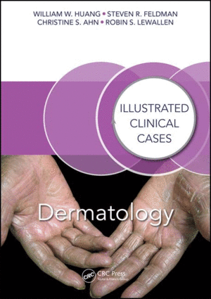 DERMATOLOGY: ILLUSTRATED CLINICAL CASES