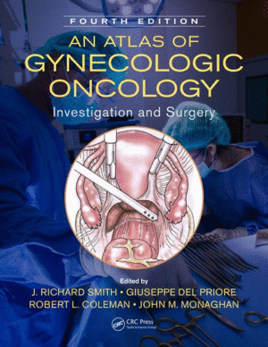 AN ATLAS OF GYNECOLOGIC ONCOLOGY. INVESTIGATION AND SURGERY, 4TH EDITION