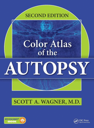 COLOR ATLAS OF THE AUTOPSY, 2ND EDITION. BOOK + EBOOK