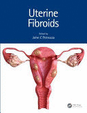 UTERINE FIBROIDS