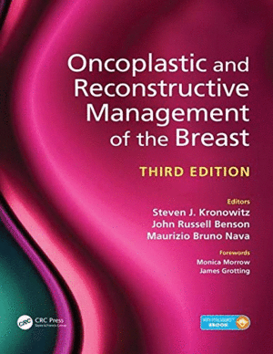 ONCOPLASTIC AND RECONSTRUCTIVE SURGERY OF THE BREAST, 3RD EDITION. BOOK + EBOOK