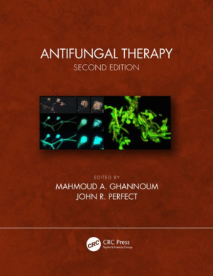ANTIFUNGAL THERAPY. 2ND EDITION