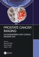 PROSTATE CANCER IMAGING. AN ENGINEERING AND CLINICAL PERSPECTIVE