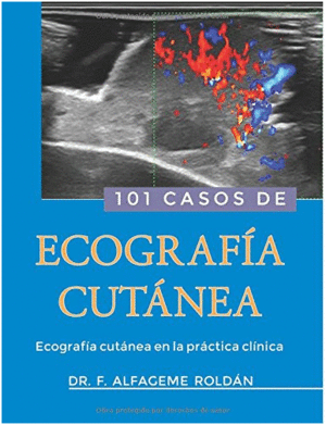101 CASOS DE ECOGRAFIA CUTANEA. ECOGRAFIA CUTANEA EN LA PRACTICA CLINICA