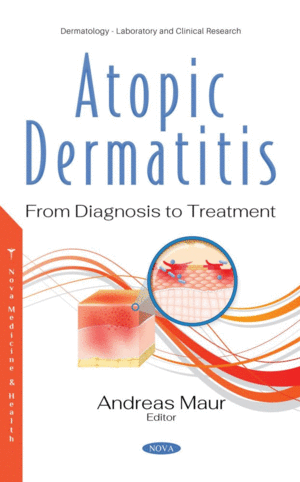 ATOPIC DERMATITIS. FROM DIAGNOSIS TO TREATMENT