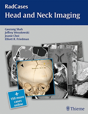 RADCASES: HEAD AND NECK IMAGING