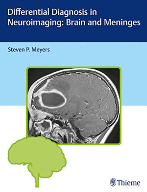 DIFFERENTIAL DIAGNOSIS IN NEUROIMAGING: BRAIN AND MENINGES