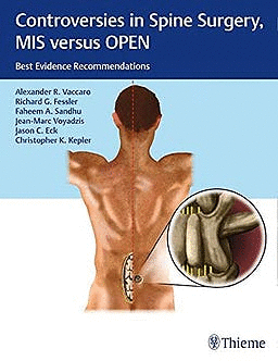 CONTROVERSIES IN SPINE SURGERY. MIS VERSUS OPEN SURGERY. BEST EVIDENCE RECOMMENDATIONS