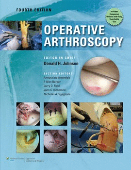 OPERATIVE ARTHROSCOPY. 4TH EDITION