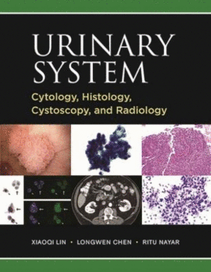 CYTOLOGY, HISTOLOGY, CYSTOSCOPY, AND RADIOLOGY OF THE URINARY SYSTEM ATLAS AND PRACTICAL GUIDE