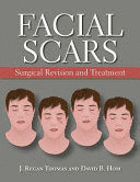 FACIAL SCARS. SURGICAL REVISION AND TREATMENT