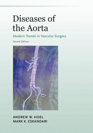 DISEASES OF THE AORTA. MODERN TRENDS IN VASCULAR SURGERY. 2ND EDITION