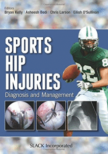 SPORTS HIP INJURIES. DIAGNOSIS AND MANAGEMENT