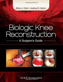 BIOLOGIC KNEE RECONSTRUCTION. A SURGEON'S GUIDE