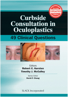 CURBSIDE CONSULTATION IN OCULOPLASTICS. 2ND EDITION