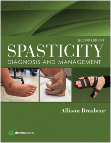 SPASTICITY. DIAGNOSIS AND MANAGEMENT. 2ND EDITION