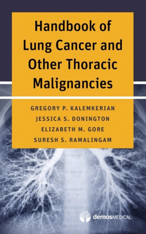 HANDBOOK OF LUNG CANCER AND OTHER THORACIC MALIGNANCIES