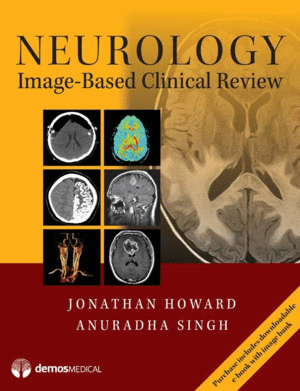 NEUROLOGY IMAGE-BASED CLINICAL REVIEW