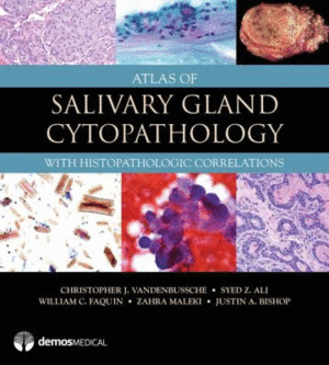 ATLAS OF SALIVARY GLAND CYTOPATHOLOGY. WITH HISTOPATHOLOGIC CORRELATIONS