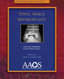 TOTAL ANKLE ARTHROPLASTY